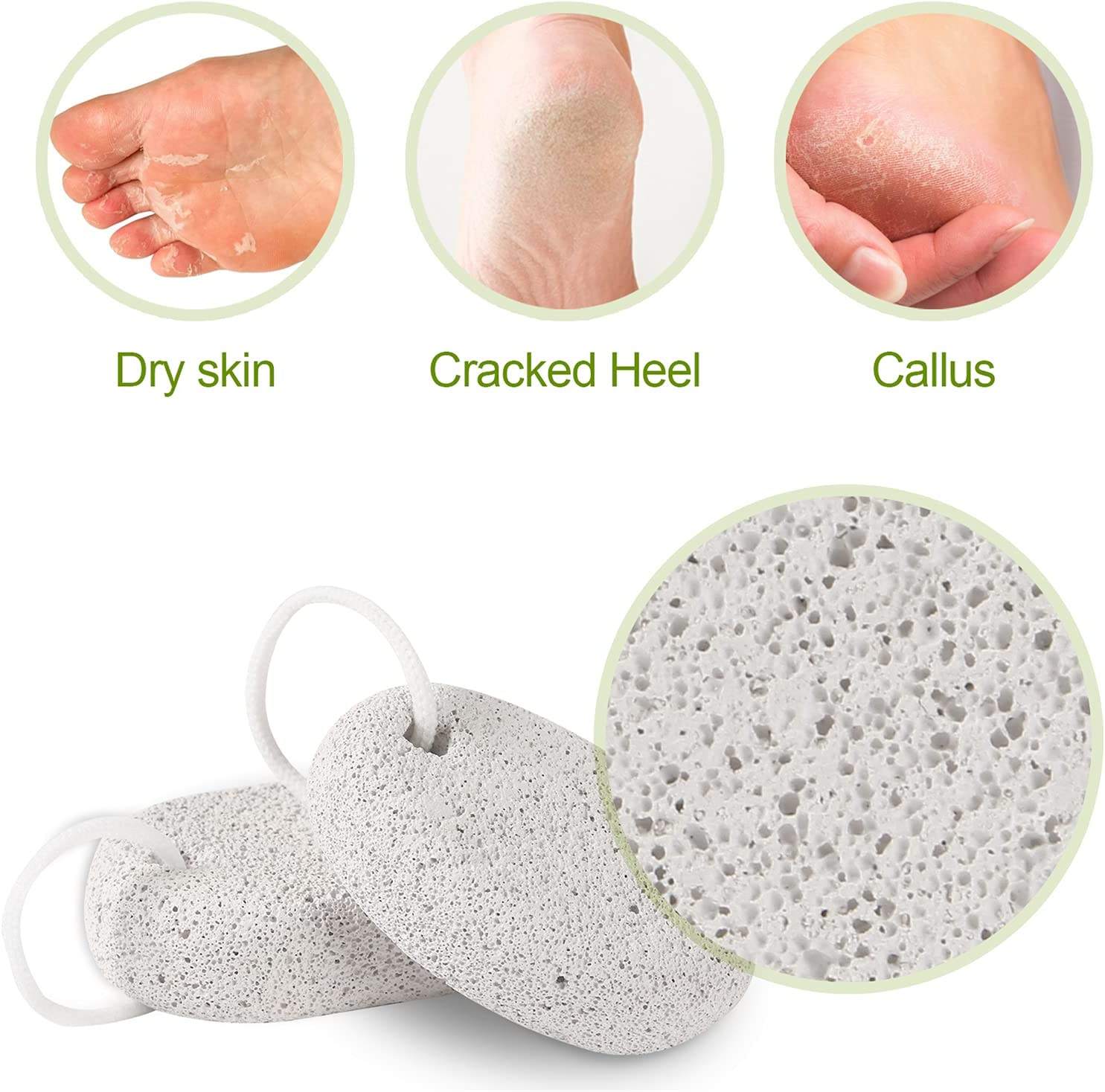 Colored natural lava pumice stone foot exfoliator with hanging rope, designed to remove dead skin, smooth rough heels, and support regular pedicure care.